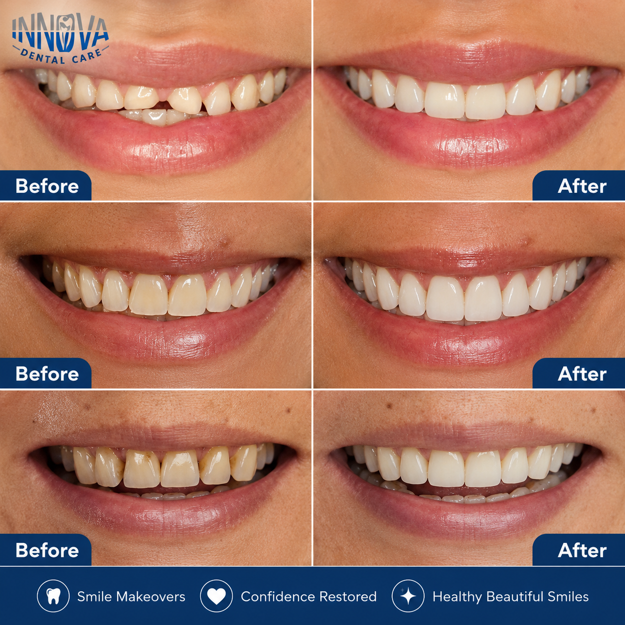 Illustrative smile transformation examples